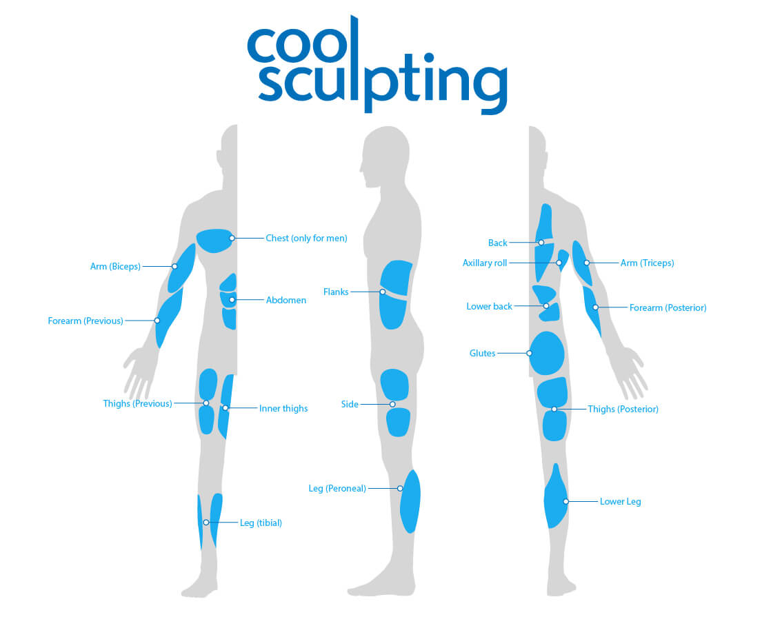 Diagrama Coolsculpting