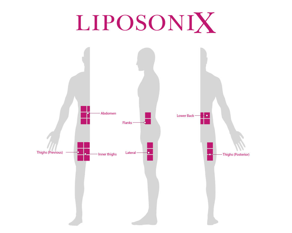 Diagrama Liposonix