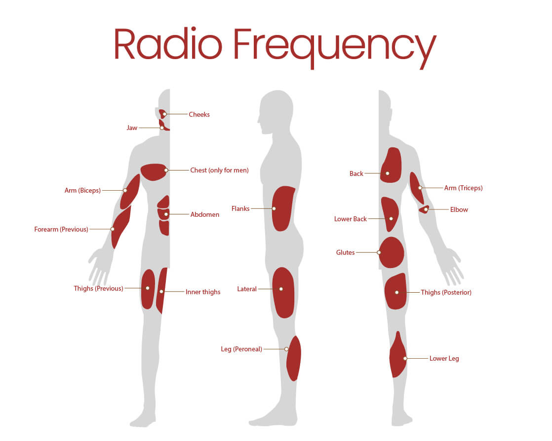 Diagrama Radiofrecuencia
