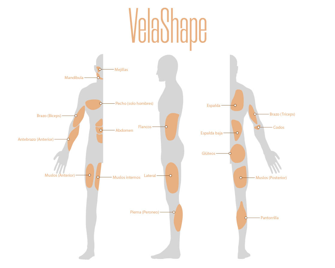 Diagrama VelaShape
